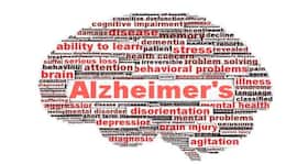 Why do neurons die in Alzheimer's disease? Why do neurons die in Alzheimer's disease?