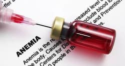 Anemia - causes, symptoms, diagnosis and treatment