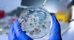 Anthrax: Everything that you need to know about the disease