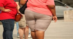 Obese women more likely to suffer hip fracture earlier than others