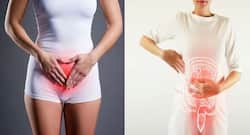 Ayurvedic treatment of stomach ulcer