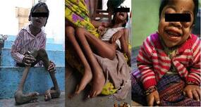 How the Bhopal gas tragedy is still affecting thousands