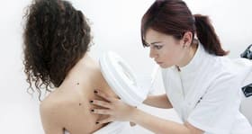 Birthmarks - all you wanted to know