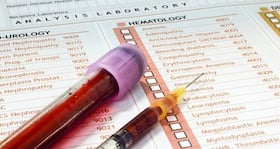 When are you going to die? A simple blood test has the answer!