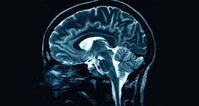 Discovered -- a new marker to predict response to chemotherapy Discovered -- a new marker to predict response to chemotherapy