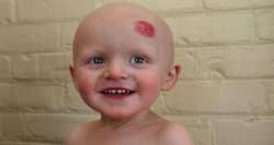 Selenium cuts cancer risk