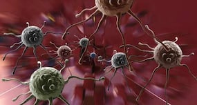 8 cancer-causers in your daily life you should be aware of