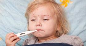 Chicken pox: Causes,diagnosis and treatment Chicken pox: Causes,diagnosis and treatment