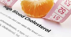Cholesterol control mega guide - all you need to know to prevent heart disease