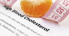 Cholesterol control mega guide - all you need to know to prevent heart disease