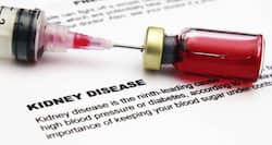 Chronic kidney disease – causes, symptoms, diagnosis, treatment and prevention