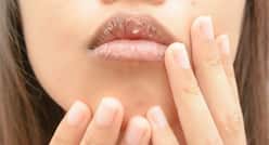 Winter Lip Care Tips : सर्दियों में नहीं फटेंगे होंठ, जब अपनाएंगी ये टिप्स