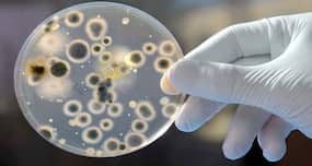 Can pets and humans harbour the same infections?