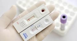 World Health Day 2014: Dengue fever diagnosis -- factors, tests and cost