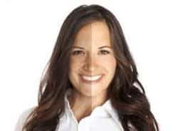 Reverse the signs of ageing with dermal fillers