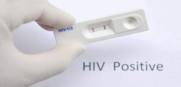 Hiv Diagnosis 5 Tests To Detect A Recent Hiv Infection