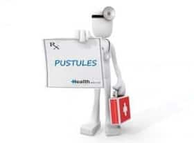 Know your medical terms: Pustules Know your medical terms: Pustules