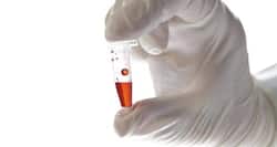Latest Ebola News: Canada vaccine effective against Ebola virus