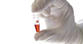 Latest Ebola News: Canada vaccine effective against Ebola virus Latest Ebola News: Canada vaccine effective against Ebola virus