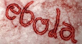 Latest Ebola News: Ebola survivor Kent Brantly donates blood to infected American