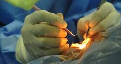 Bandra acid attack: Treating doctor explains how stem cell therapy will give her vision back