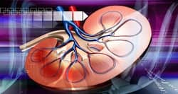 5 foods to help you recover from kidney disease