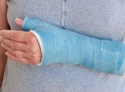 Fractures: First-aid and treatment options you should know about