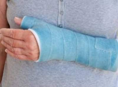 Fractures: First-aid and treatment options you should know about ...