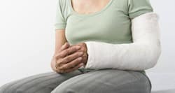 Fractures – first aid, emergency care, treatment and prevention