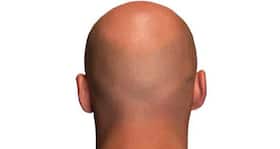 New revolutionary research might just be the answer to hair loss! New revolutionary research might just be the answer to hair loss!