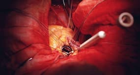 Are you going through unnecessary invasive tests for your heart?