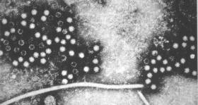 Hepatitis E: All you need to know Hepatitis E: All you need to know
