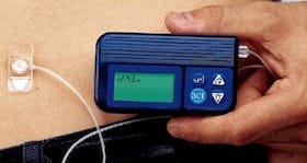 Insulin pumps could spare diabetics painful injections Insulin pumps could spare diabetics painful injections