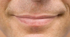 How can a guy get rid of dry lips? (Male grooming query)