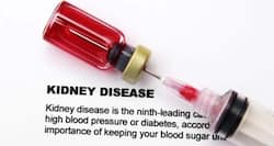 8 tests for checking if your kidneys are functioning fine