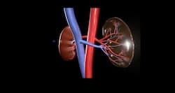 Kidney disease can be a silent killer!