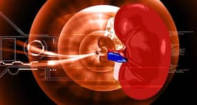 Beware - gastroenteritis can lead to kidney failure