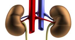 6 expert tips to treat and prevent kidney stones