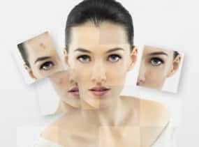 Peel off years from your face and look younger with laser skin resurfacing