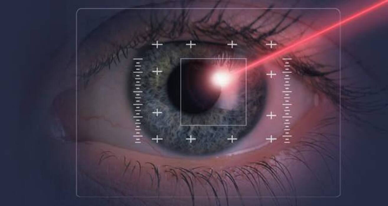 LASIK Surgery: Say Goodbye To Glasses In A Painless Manner