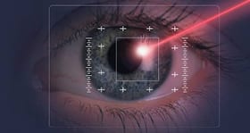 LASIK surgery - things to keep in mind before undergoing one LASIK surgery - things to keep in mind before undergoing one
