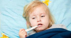 Mumps, measles makes a comeback in the US