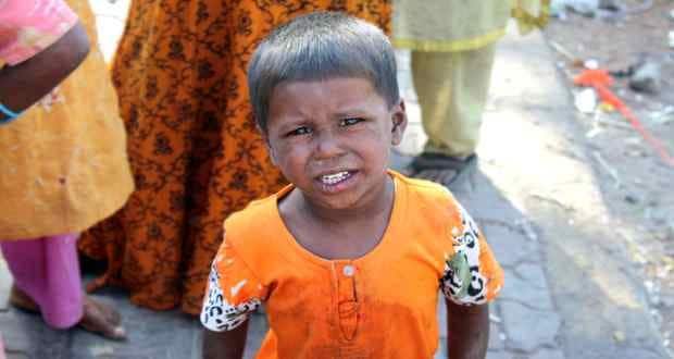 47% of all deaths due to measles in India | TheHealthSite.com