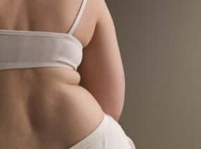 Obese people always likelier to suffer a heart attack