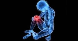 Protelos, an osteoporosis drug could slow down osteoarthritis.