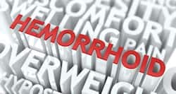 Treatment for piles or hemorrhoids -- what you should expect during the process