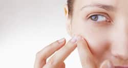 Beauty Tip #24: Get rid of pimples with this home remedy