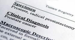 Diagnosis of prostate cancer