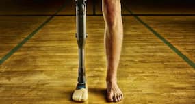 Indian company to make prosthetic legs for disabled Afghans
