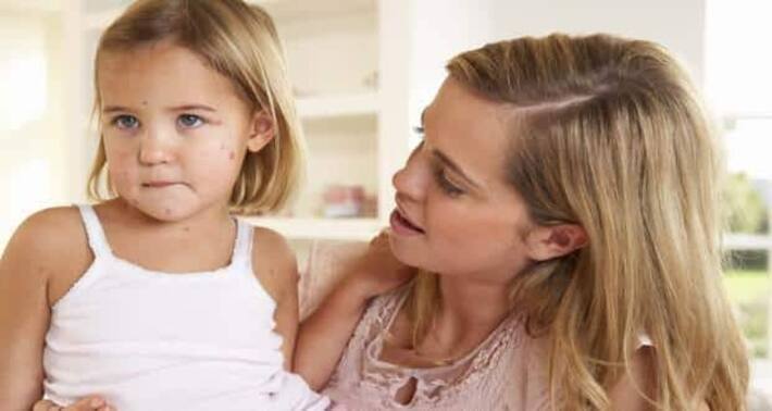 Rubella – causes, symptoms, diagnosis, treatment and prevention